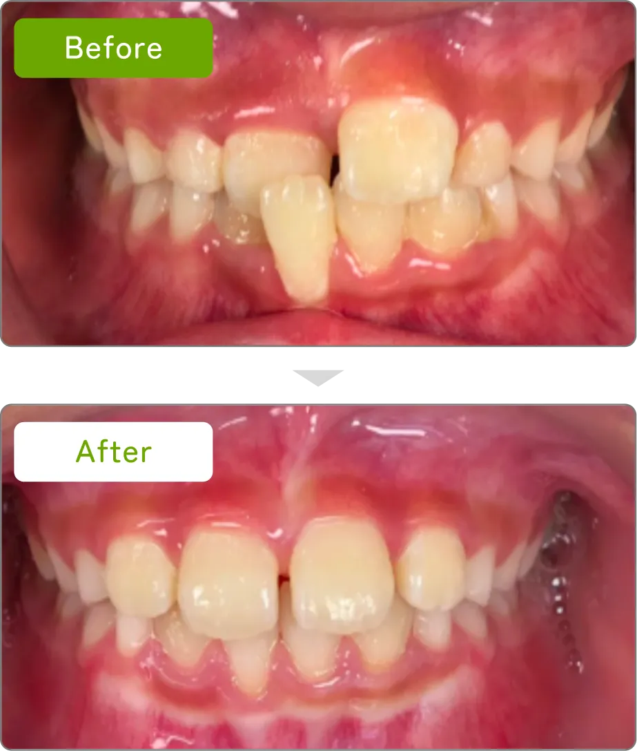 case03